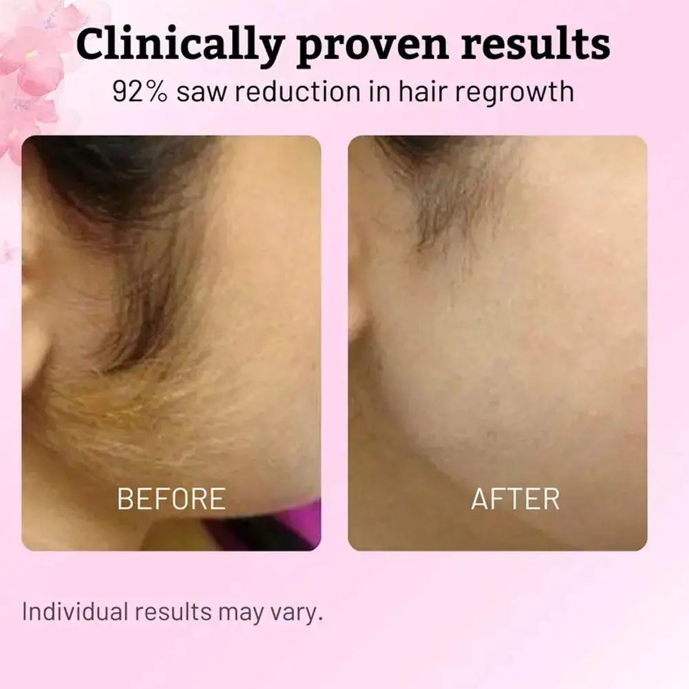 Hair Removal Care Serum Relieves Gentle Moisturizing Care | Premium Care