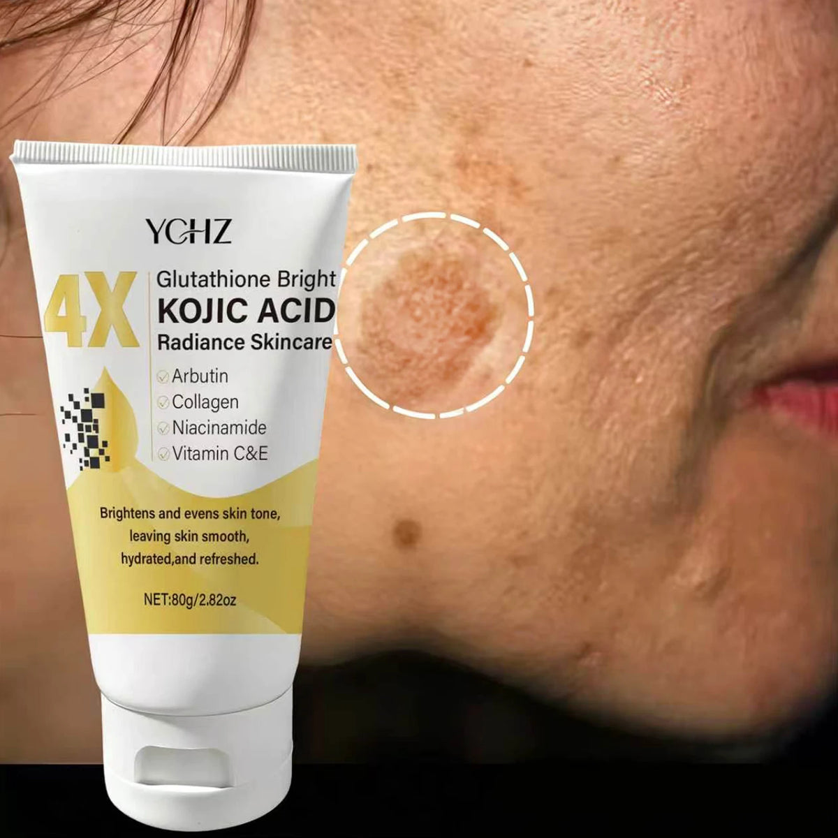 Kojic Acid Face Cream Evens Out Skin Tone | Premium Care
