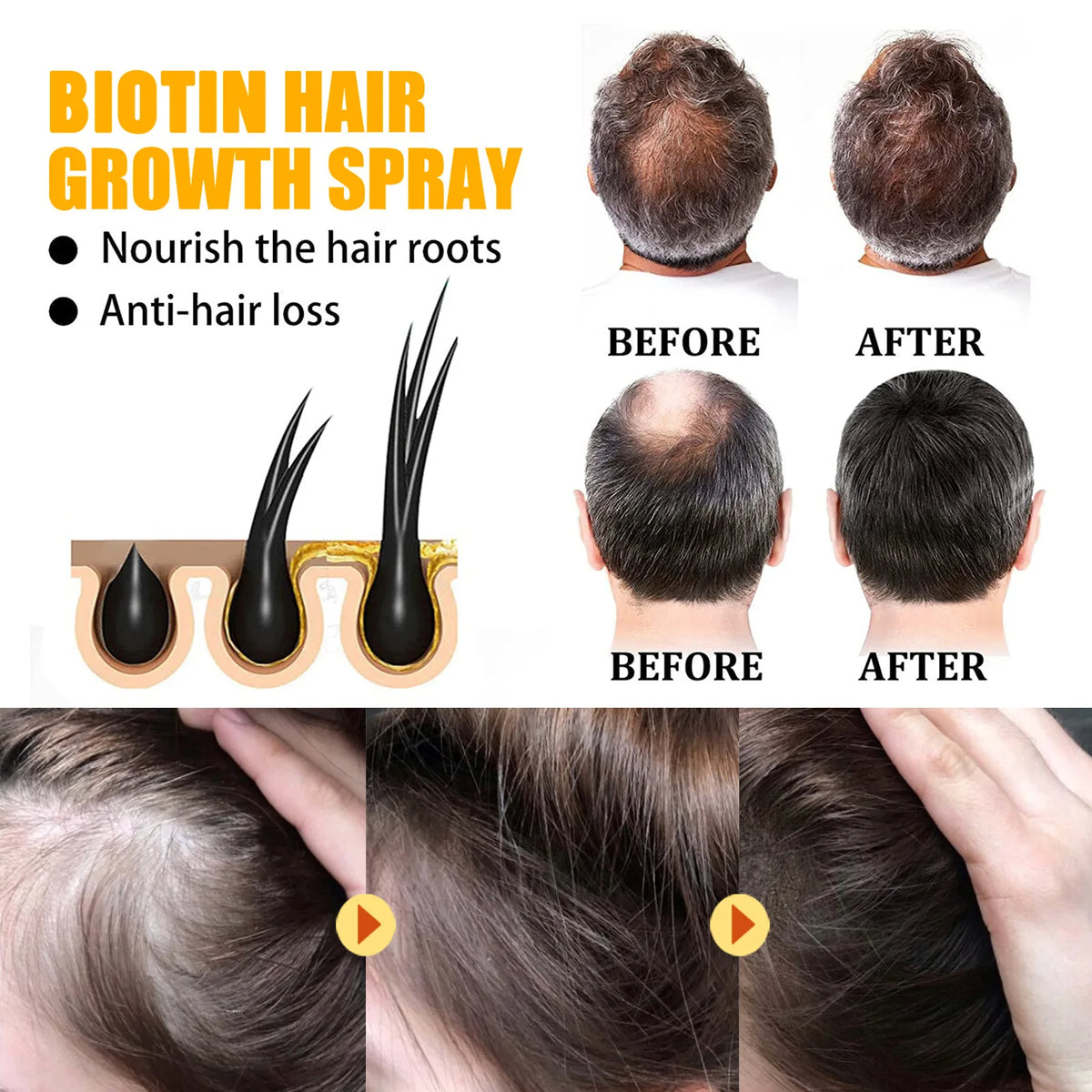Biotin Hair Care Spray Nourish Scalp Hair Follicle | Premium Care