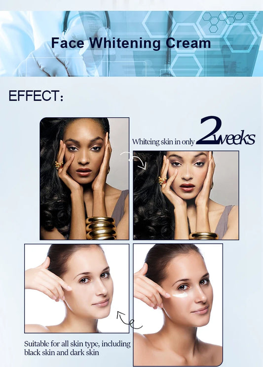 Korean Best Bleaching Brightening Face Whitening Cream for Dark Skin for Women