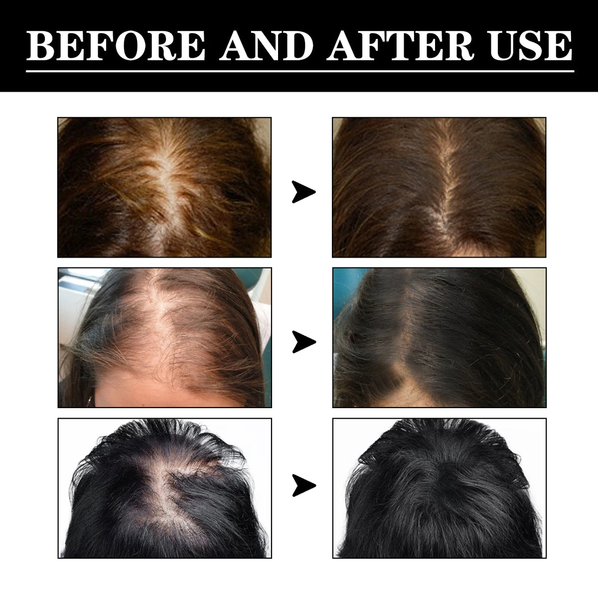 Hair Care Essence Has Good Permeability Penetrates Into | Premium Care