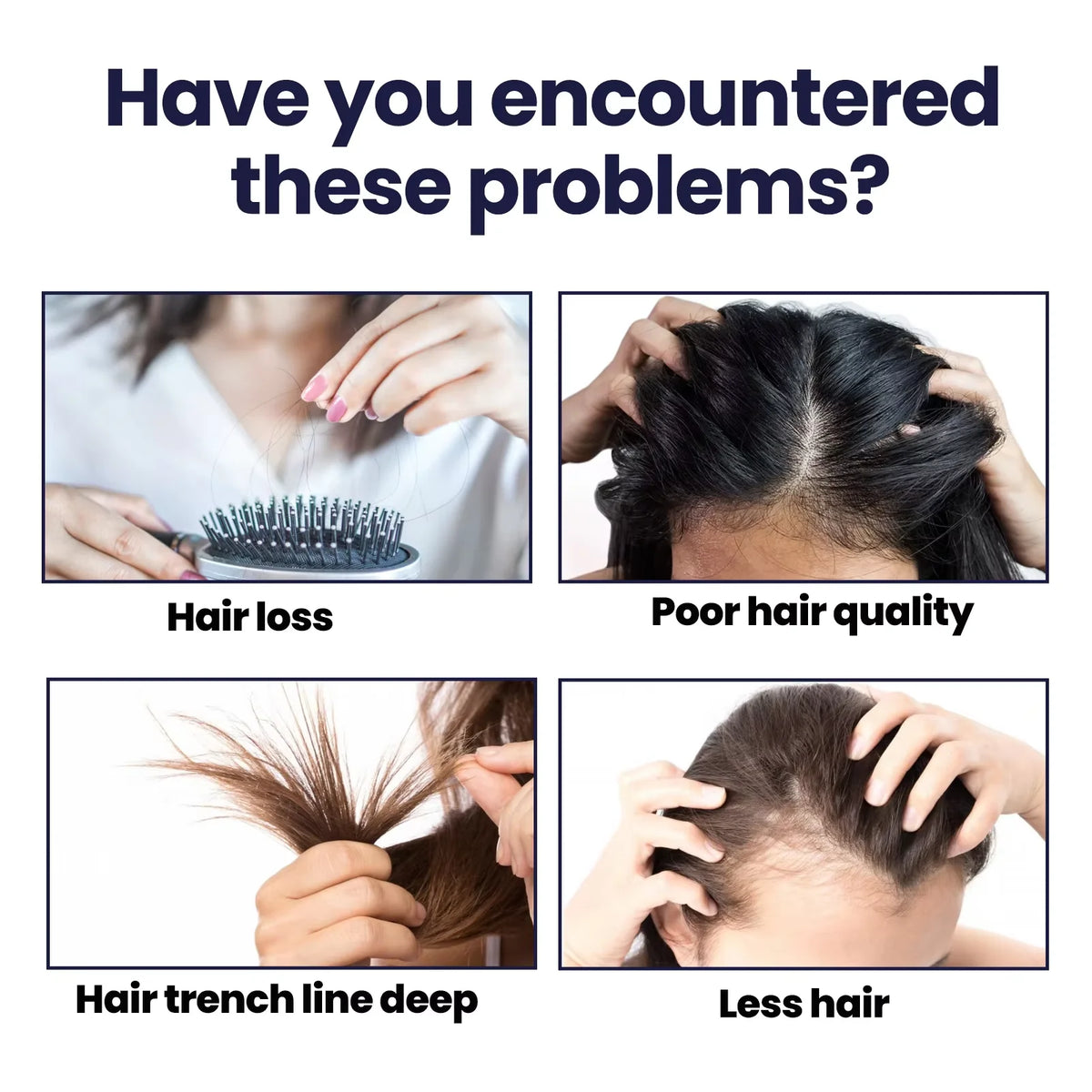 Hair Growth Spray Nourishing Moisturizing Thicker Longer Repair | Premium Care