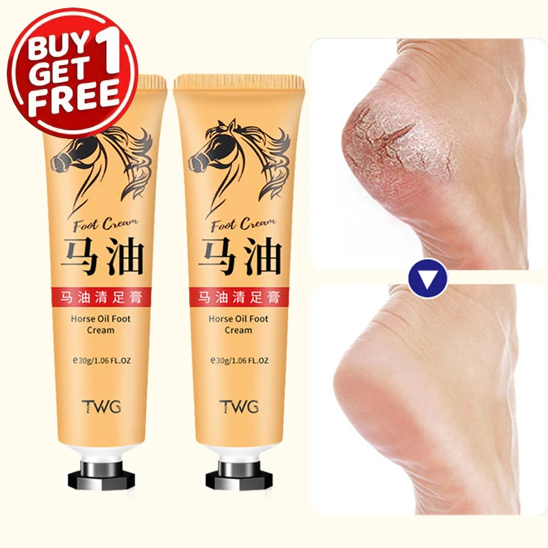 Ma You Qing Foot Cream Moisturizing Foot Cream | Premium Care