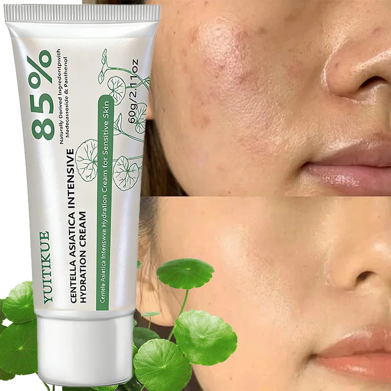 YUITIKUE Centella Asiatica Cream 85% Intensive Hydration Repair for Sensitive Skin with Panthenol 60g