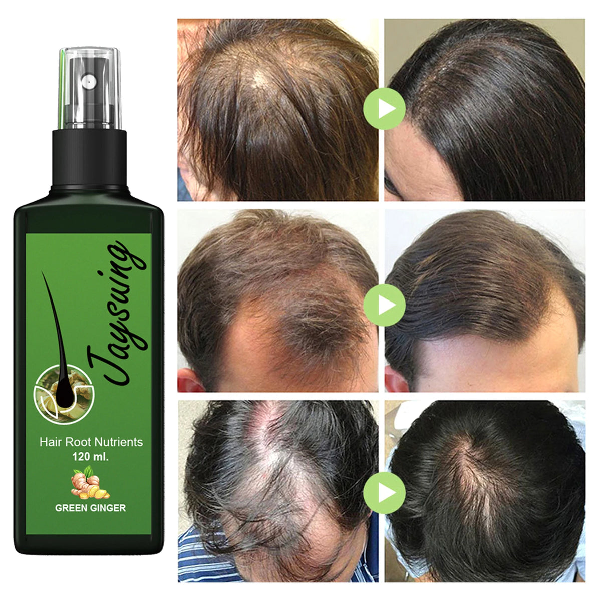 Hair Care Serum Gently Nourishing Massages The Scalp | Premium Care