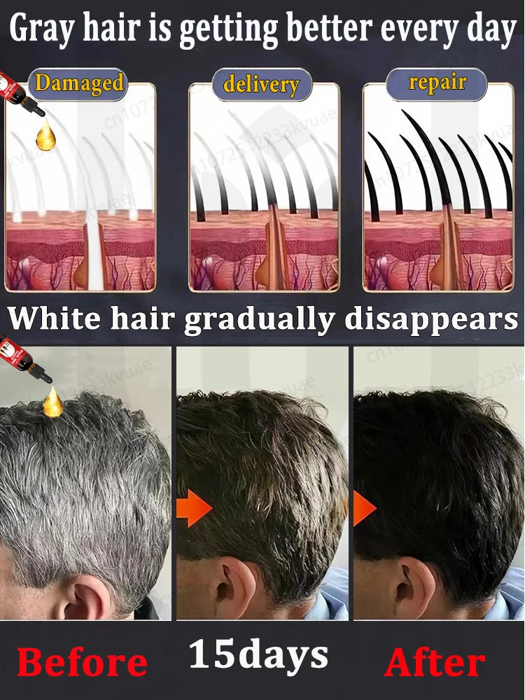 White Hair Turns Black Instantly Regaining Youthful Confidence | Premium Care