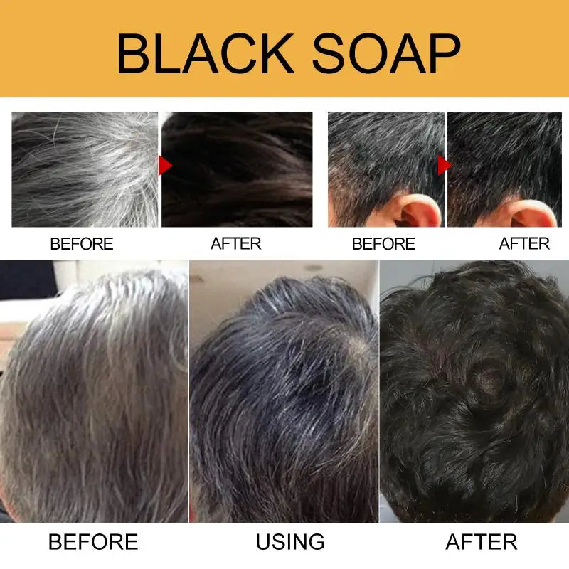 White To Black Hair Soap Effectively Remove White | Premium Care