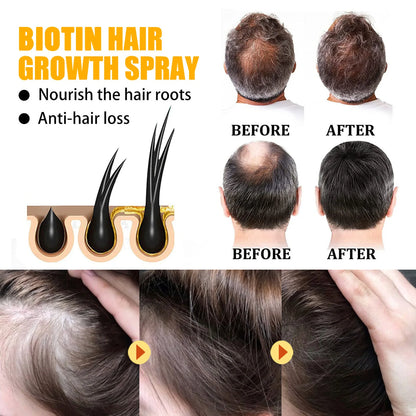 Biotin Hair Care Spray Nourish Scalp Hair Follicle | Premium Care