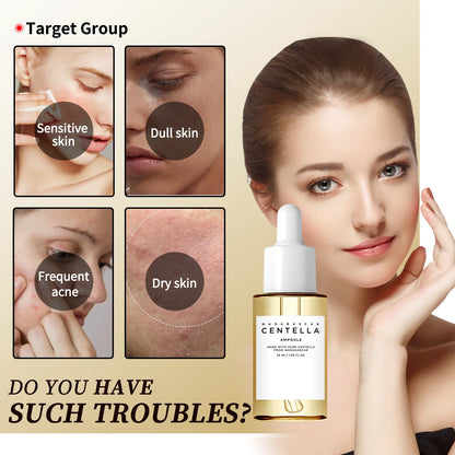 Centella Asiatica Brightening Serum Calms Irritation Reduces Breakouts | Premium Care