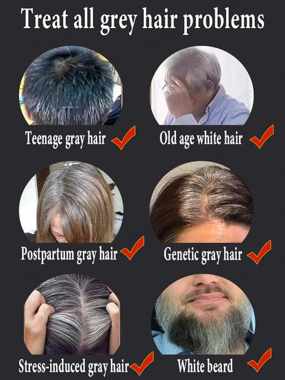White Hair Turns Black Instantly Regaining Youthful Confidence | Premium Care