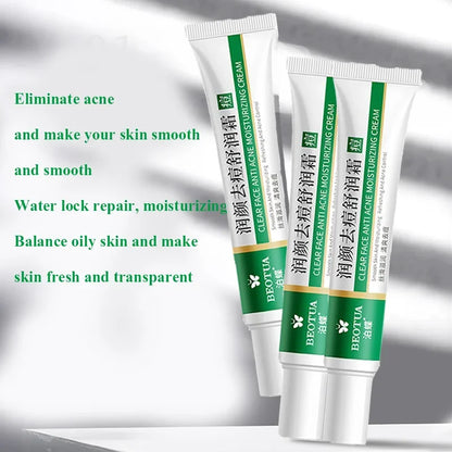 Herbal Acne Treatment Cream Face Scar Blackhead Remover | Premium Care