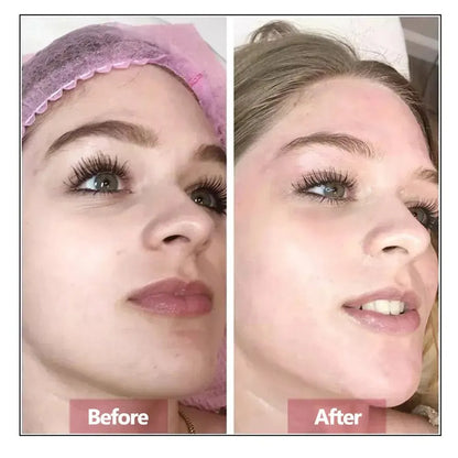 Hyaluronic Acid Face Serum Essence Skin Repair Rejuvenation | Premium Care