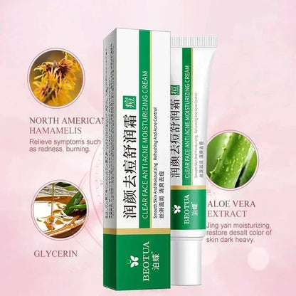 Herbal Acne Treatment Cream Face Scar Blackhead Remover | Premium Care