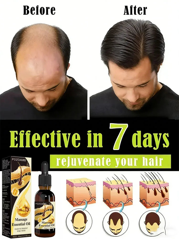 Nourish Hair Roots Repair Damage From The Root | Premium Care