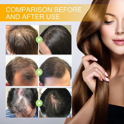 Biotin Hair Care Spray Nourish Scalp Hair Follicle | Premium Care