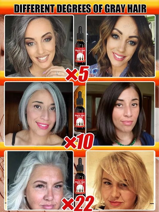 Old White Hair Gray Hair Restore Youthful Hair | Premium Care